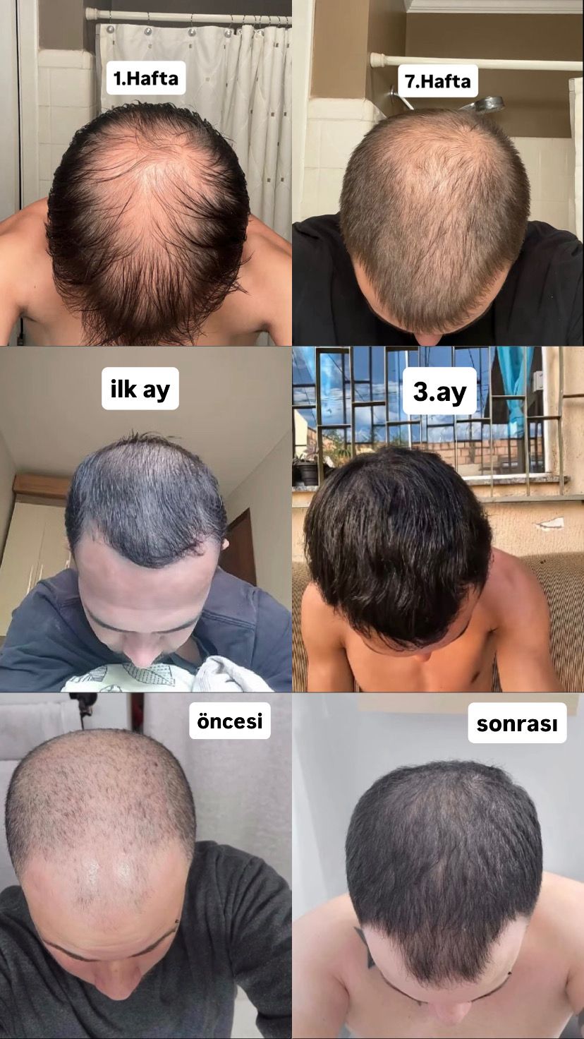 FURELIXIR SAÇ UZATMA SERUMU