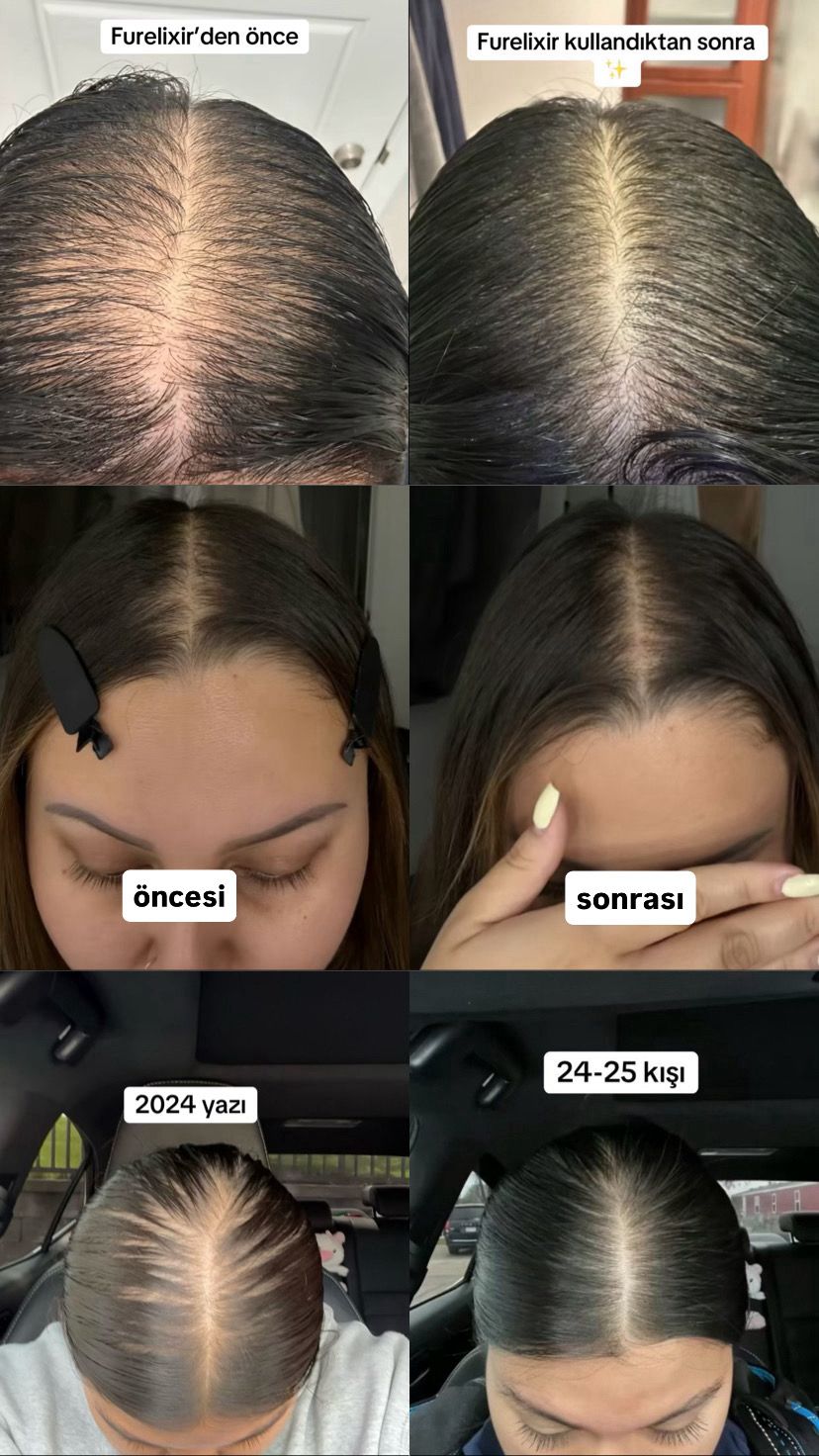 FURELIXIR SAÇ UZATMA SERUMU