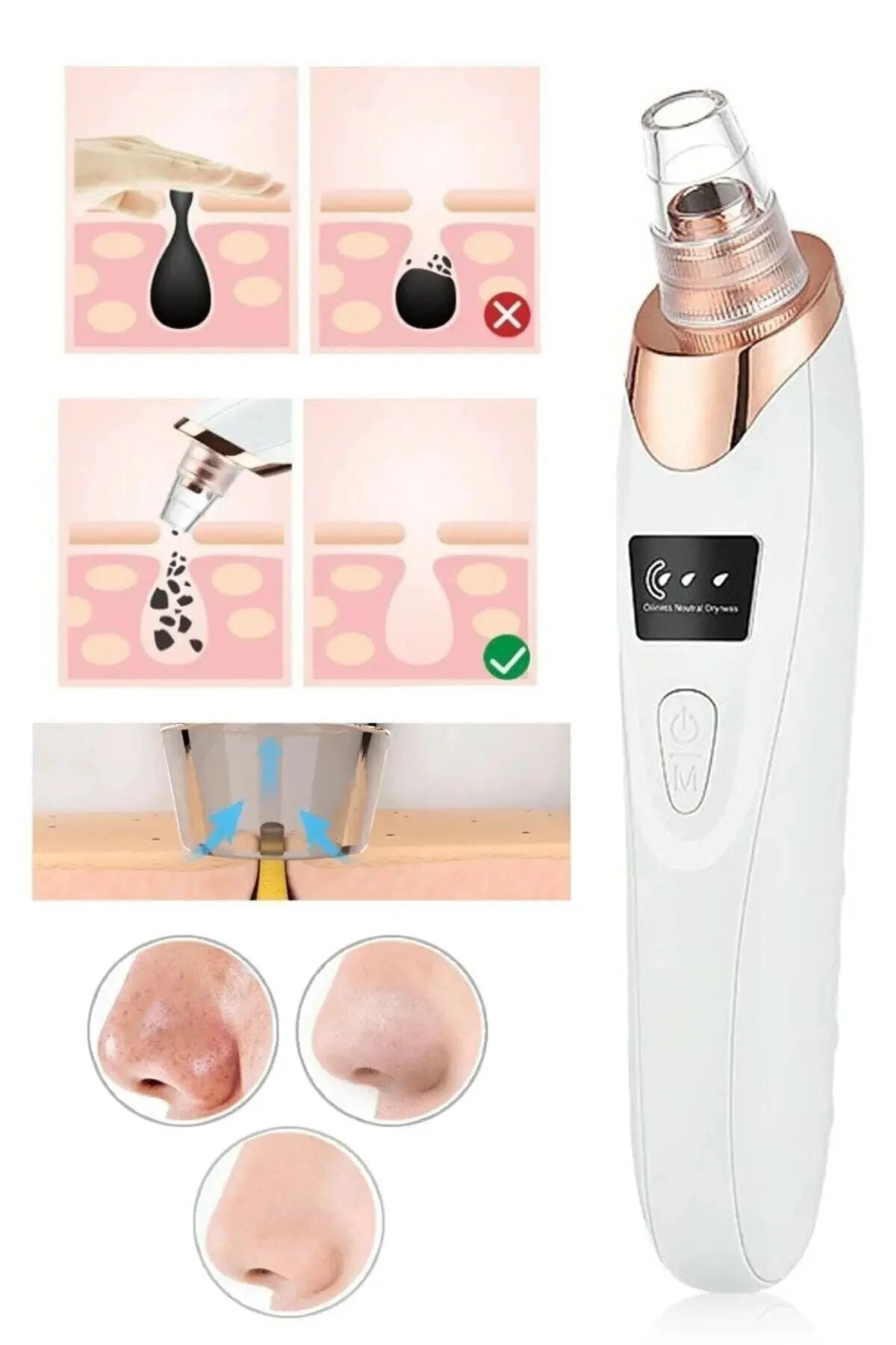 DİJİTAL GÖSTERGELİ 5 BAŞLIKLI CİLT TEMİZLEME VAKUM ALETİ